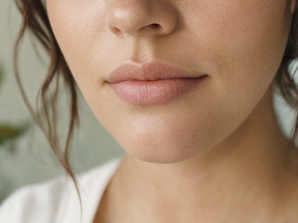 Lip Fillers