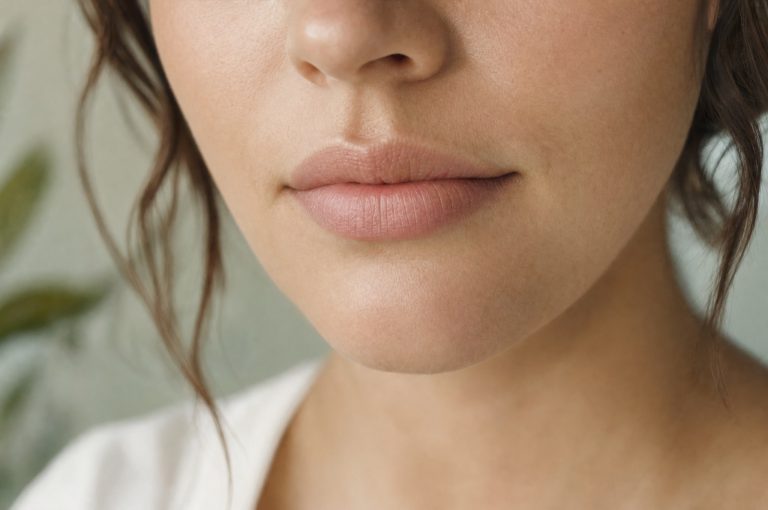 Lip Fillers